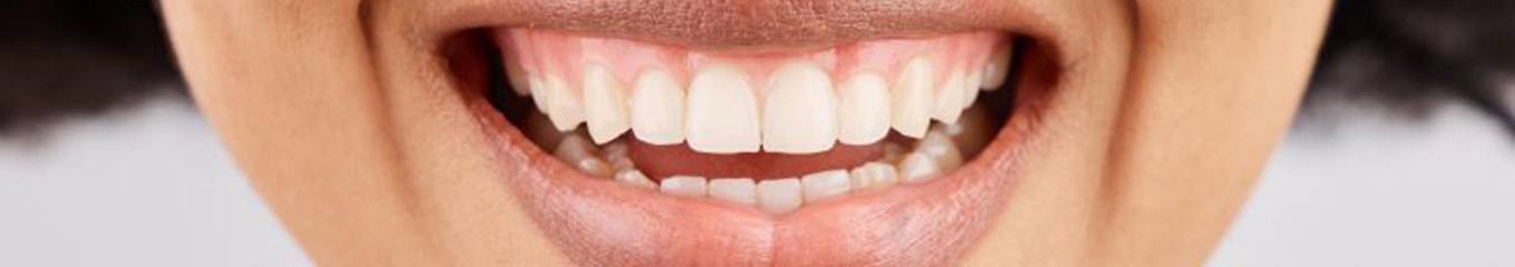 Close-up of woman’s healthy smile with beautiful gums