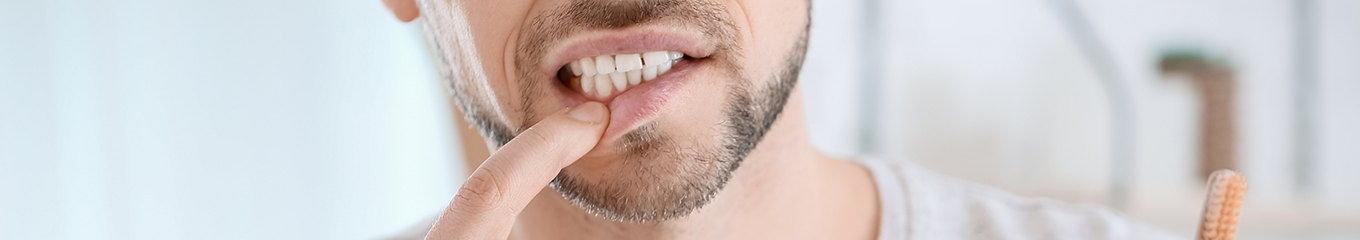 Man pointing to his gums