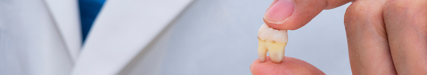 Dentist holding an extracted tooth