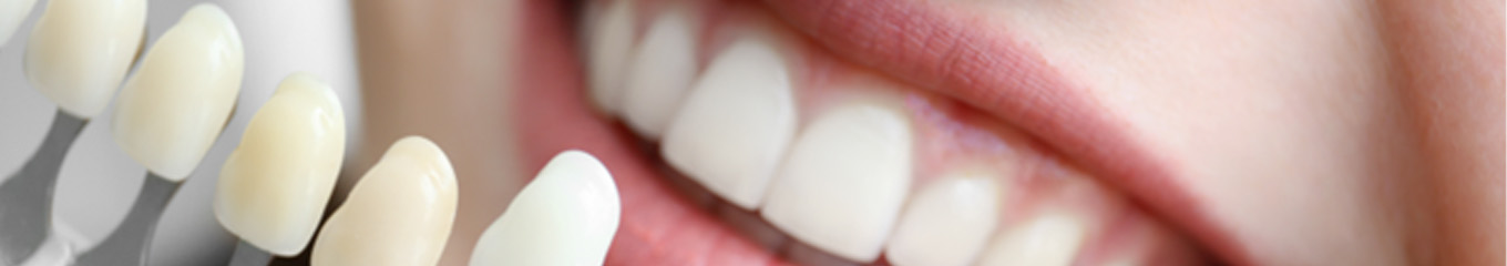 Dental shade guide close to woman’s smile